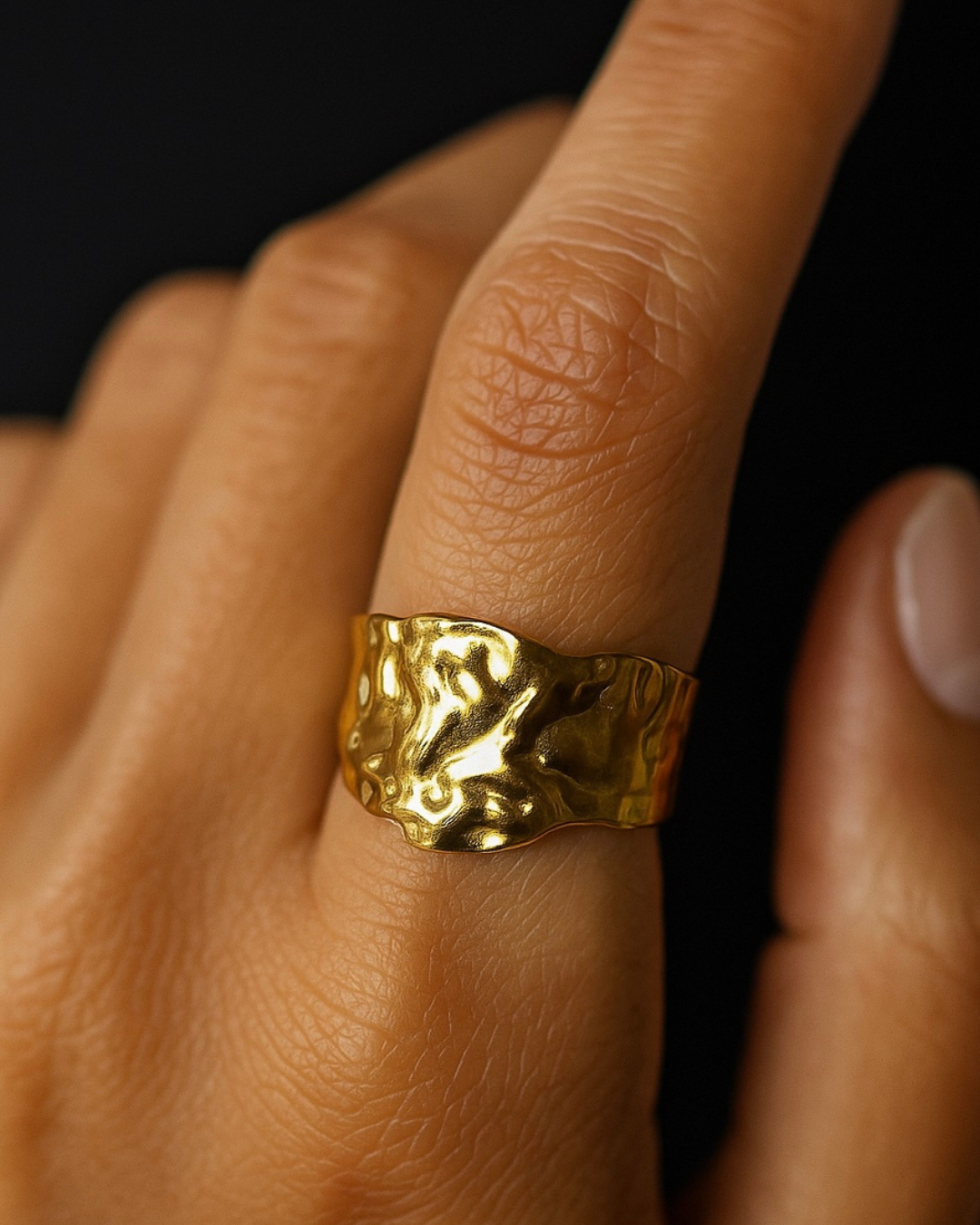 Anillo Ignis